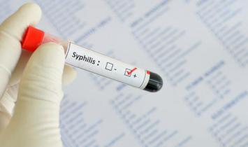 Причини и лечение на латентен сифилис Колко дълго да се лекува сифилис в ранен латентен стадий